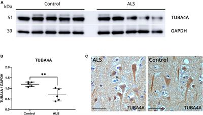 TUBA4A downregulation as observed in ALS post-mortem motor cortex causes ALS-related abnormalities in zebrafish